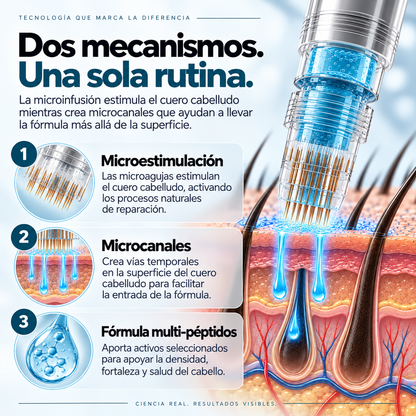 Sistema de microinfusión capilar para la caída del cabello