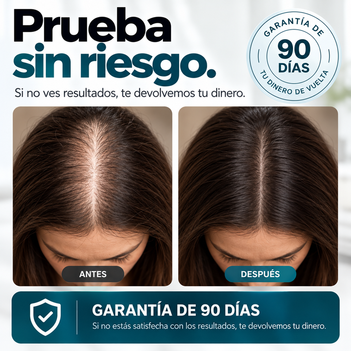 Sistema de microinfusión capilar para la caída del cabello