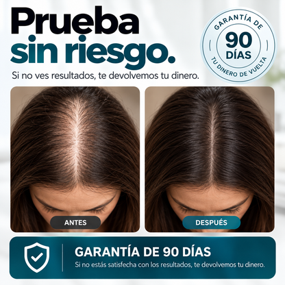 Sistema de microinfusión capilar para la caída del cabello